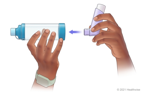 Person putting mouthpiece of meter-dose inhaler into end of spacer.