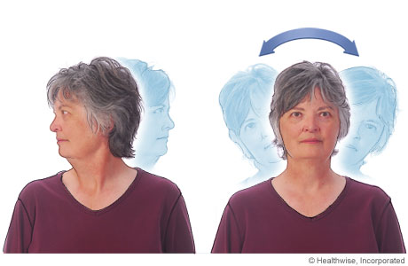 Neck stretches for ankylosing spondylitis Neck stretches for ankylosing spondylitis