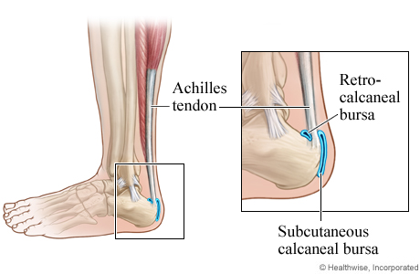 Retrocalcaneal and subcutaneous calcaneal bursa.