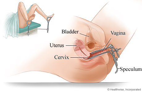 Pelvic examination using a speculum