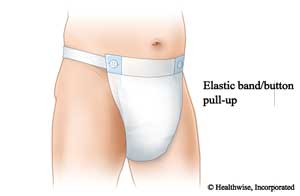 Pull-up adult underwear with elastic bands that attach to the front.