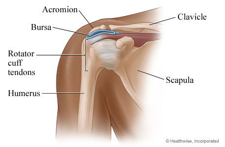 Bursitis of the shoulder.