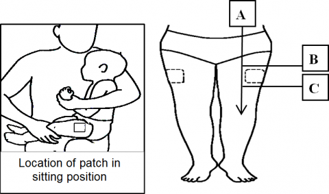 50h_location-of-patch-leg